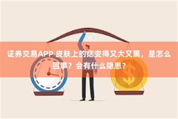 证券交易APP 皮肤上的痣变得又大又黑，是怎么回事？会有什么隐患？